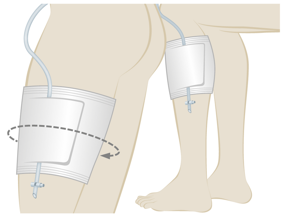 UROMED Beinbeutelhalter für Urinbeinbeutel, latexfrei